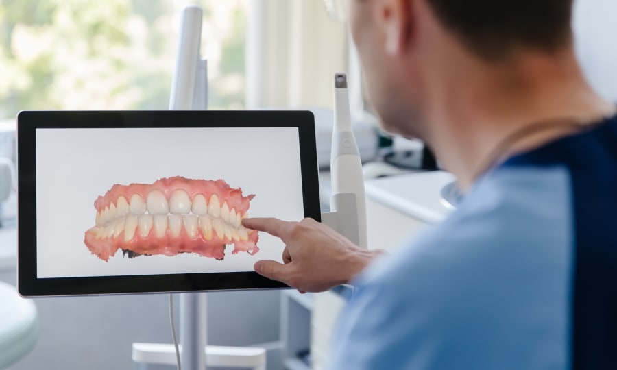 Digital Impressions with iTero for Clear Aligners at Woodstock Orthodontics