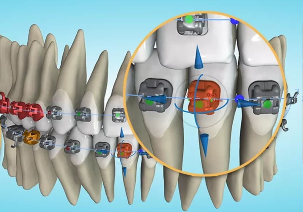 An example of what the screen looks like for digital orthodontics.